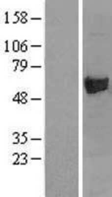 Western Blot: Asparagine synthetase Overexpression Lysate [NBL1-07768]