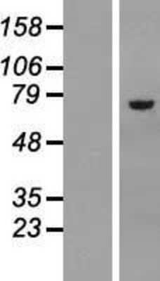 Western Blot: Asparagine synthetase Overexpression Lysate [NBL1-07770]