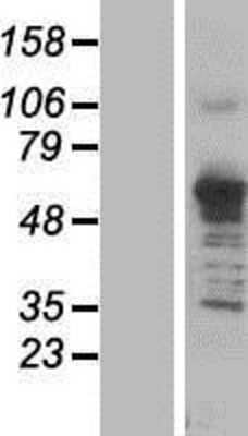 Western Blot: Asparagine synthetase Overexpression Lysate [NBP2-04785]