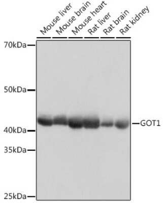 Western Blot: Aspartate Aminotransferase Antibody (5J1B4) [NBP3-15347]