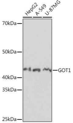 Western Blot: Aspartate Aminotransferase Antibody (5J1B4) [NBP3-15347]
