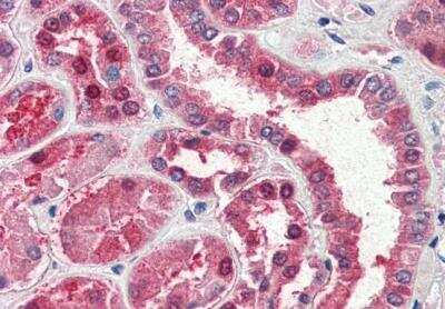 Immunohistochemistry-Paraffin: Aspartate Aminotransferase Antibody [NB100-93403]