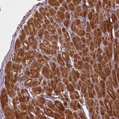 Immunohistochemistry-Paraffin: Aspartate Aminotransferase Antibody [NBP2-55813]