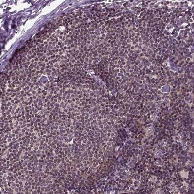 Immunohistochemistry-Paraffin: Aspartate Aminotransferase Antibody [NBP2-55813]