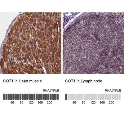 Immunohistochemistry-Paraffin: Aspartate Aminotransferase Antibody [NBP2-55813]