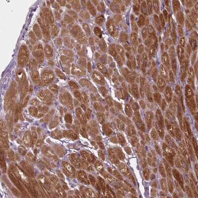 Immunohistochemistry-Paraffin: Aspartate Aminotransferase Antibody [NBP2-57518]