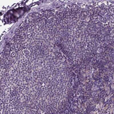 Immunohistochemistry-Paraffin: Aspartate Aminotransferase Antibody [NBP2-57518]