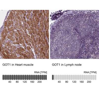 Immunohistochemistry-Paraffin: Aspartate Aminotransferase Antibody [NBP2-57518]