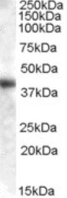 Western Blot: Aspartate Aminotransferase Antibody [NB100-93403]