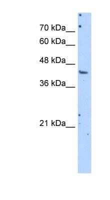 Western Blot: Aspartate Aminotransferase Antibody [NBP1-54778]