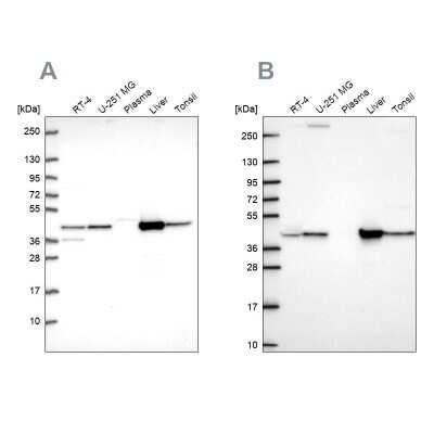 Western Blot: Aspartate Aminotransferase Antibody [NBP2-55813]
