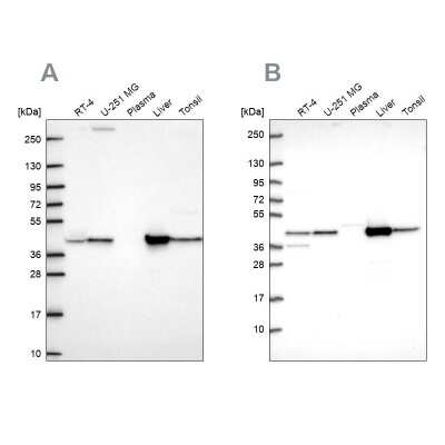 Western Blot: Aspartate Aminotransferase Antibody [NBP2-57518]
