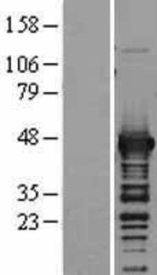 Western Blot: Aspartate Aminotransferase Overexpression Lysate [NBL1-11207]