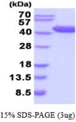 SDS-PAGE: Recombinant Human Aspartate Aminotransferase His Protein [NBP2-52179]