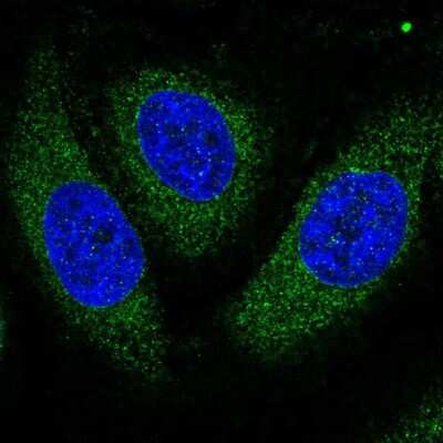 Immunocytochemistry/ Immunofluorescence: Aspartate beta hydroxylase Antibody [NBP2-58045]