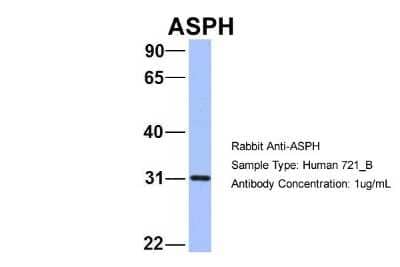 Western Blot: Aspartate beta hydroxylase Antibody [NBP1-69229]