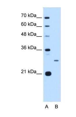 Western Blot: Aspartate beta hydroxylase Antibody [NBP1-69230]