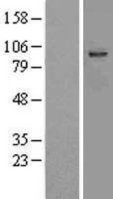 Western Blot: Aspartate beta hydroxylase Overexpression Lysate [NBL1-07773]