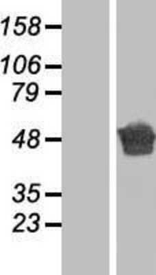 Western Blot: Aspartate beta hydroxylase Overexpression Lysate [NBP2-06019]