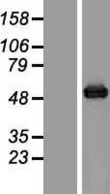 Western Blot: Aspartate beta hydroxylase Overexpression Lysate [NBP2-06020]