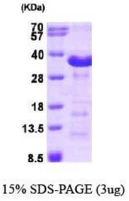 SDS-PAGE: Recombinant Human Aspartate beta hydroxylase His Protein [NBP1-40403]