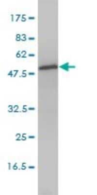 Western Blot: Aspartyl Aminopeptidase Antibody (2F9-3A7) [H00023549-M01]