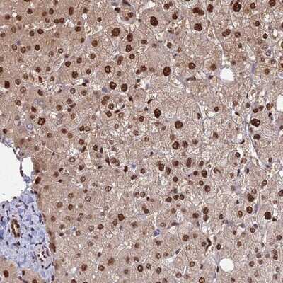 Immunohistochemistry-Paraffin: Aspartyl Aminopeptidase Antibody [NBP1-91684]