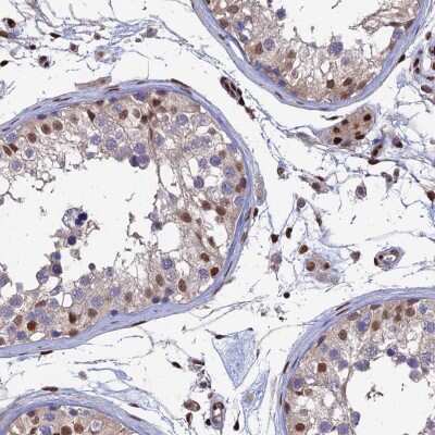 Immunohistochemistry-Paraffin: Aspartyl Aminopeptidase Antibody [NBP1-91684]