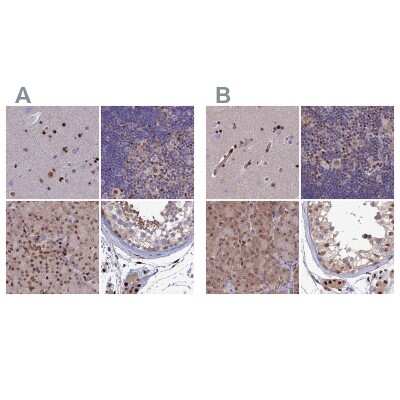 Immunohistochemistry-Paraffin: Aspartyl Aminopeptidase Antibody [NBP1-91684]