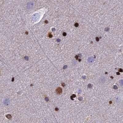 Immunohistochemistry-Paraffin: Aspartyl Aminopeptidase Antibody [NBP1-91684]
