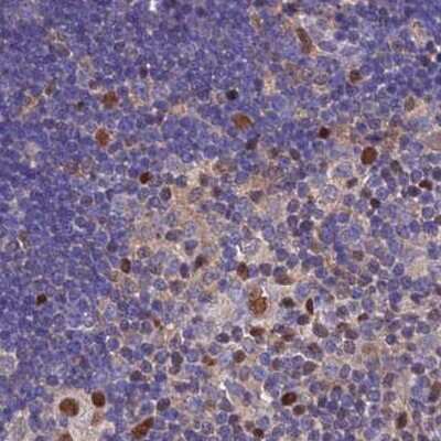 Immunohistochemistry-Paraffin: Aspartyl Aminopeptidase Antibody [NBP1-91684]