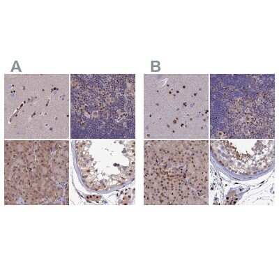 Immunohistochemistry-Paraffin: Aspartyl Aminopeptidase Antibody [NBP1-91685]