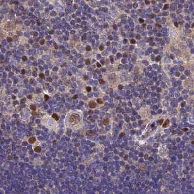 Immunohistochemistry-Paraffin: Aspartyl Aminopeptidase Antibody [NBP1-91685]