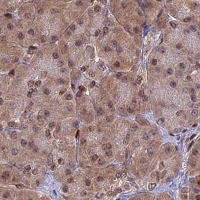 Immunohistochemistry-Paraffin: Aspartyl Aminopeptidase Antibody [NBP1-91685]