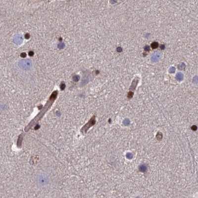Immunohistochemistry-Paraffin: Aspartyl Aminopeptidase Antibody [NBP1-91685]