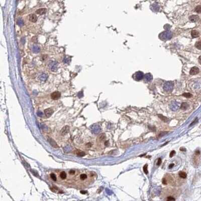 Immunohistochemistry-Paraffin: Aspartyl Aminopeptidase Antibody [NBP1-91685]