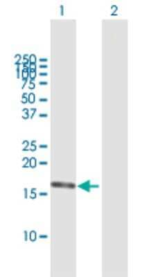 Western Blot: Aspartyl Aminopeptidase Antibody [H00023549-B01P]