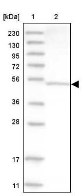 Western Blot: Aspartyl Aminopeptidase Antibody [NBP1-91684]