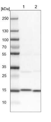 Western Blot: Aspartyl Aminopeptidase Antibody [NBP1-91685]