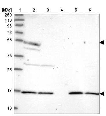 Western Blot: Aspartyl Aminopeptidase Antibody [NBP1-91685]
