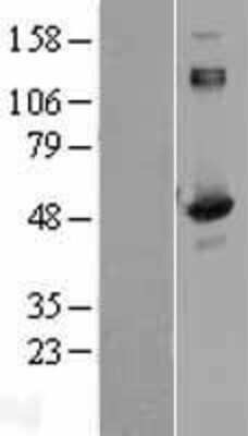 Western Blot: Aspartyl Aminopeptidase Overexpression Lysate [NBL1-09973]