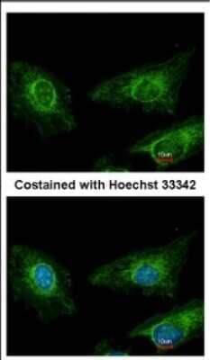 Immunocytochemistry/ Immunofluorescence: Asporin Antibody [NBP2-15492]