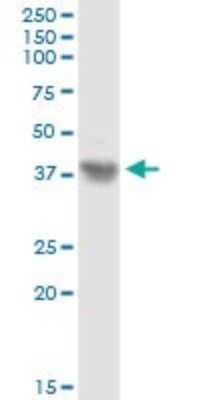 Western Blot: Asporin Antibody [H00054829-D01P]