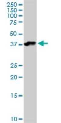 Western Blot: Asporin Antibody [H00054829-D01P]