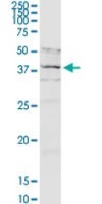 Western Blot: Asporin Antibody [H00054829-D01P]