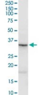 Western Blot: Asporin Antibody [H00054829-D01P]