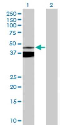 Western Blot: Asporin Antibody [H00054829-D01P]