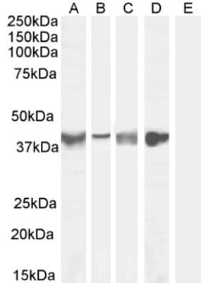 Western Blot: Asporin Antibody [NB100-1514]