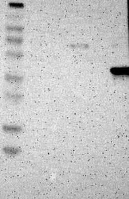 Western Blot: Asporin Antibody [NBP3-17805]