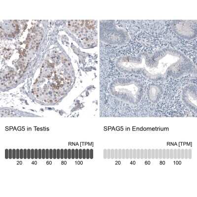 Immunohistochemistry-Paraffin: Astrin Antibody (CL10078) [NBP2-88942]